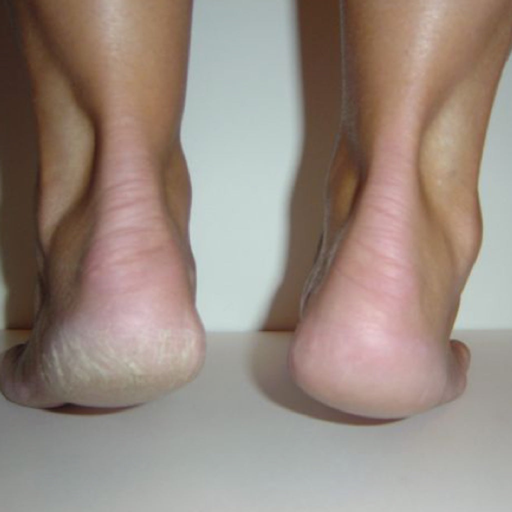 LYKKEクラックドヒールバームラージ  67g