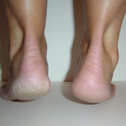 LYKKEクラックドヒールバームラージ　 67g